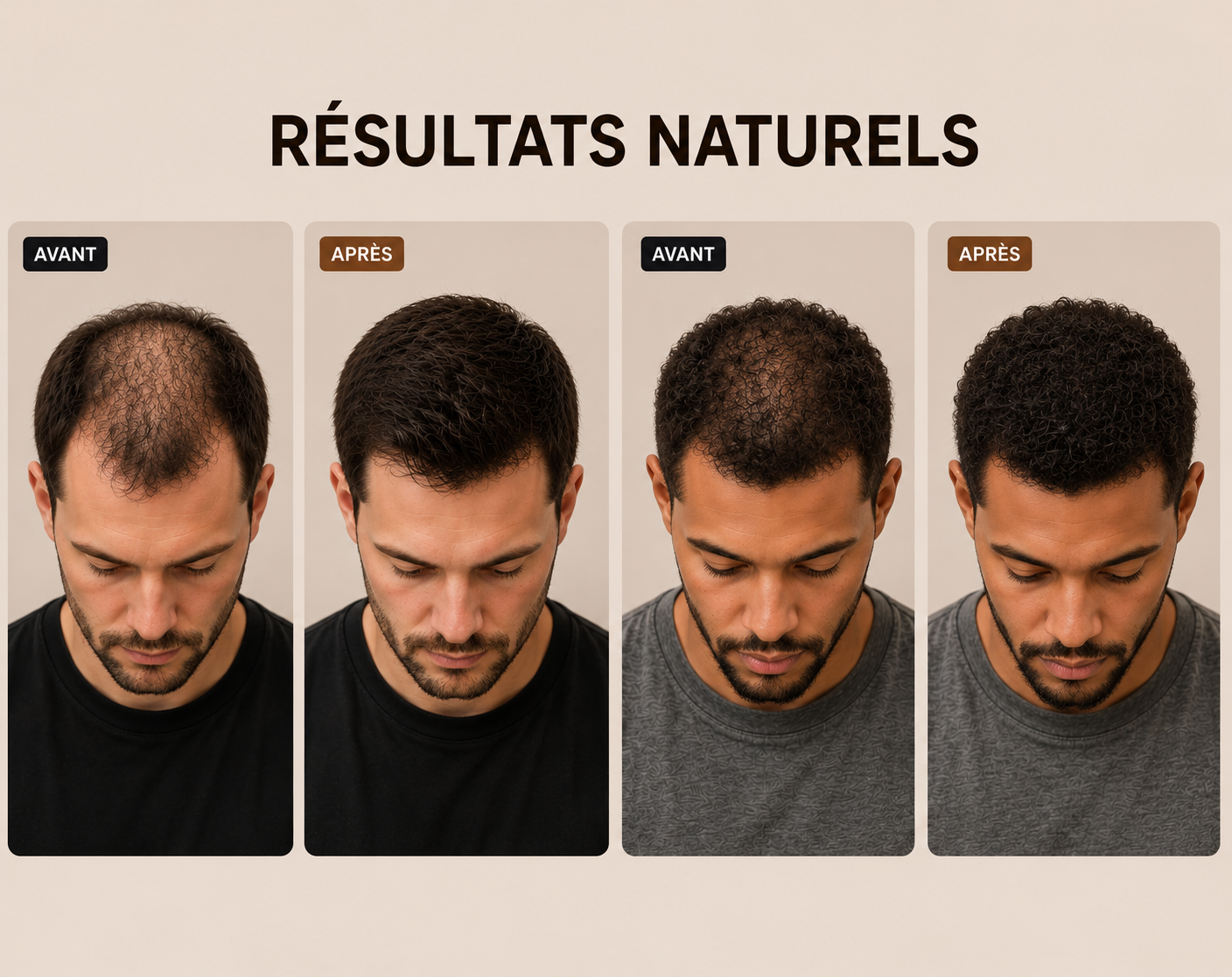 Fibres Capillaires Densifiantes Stenal